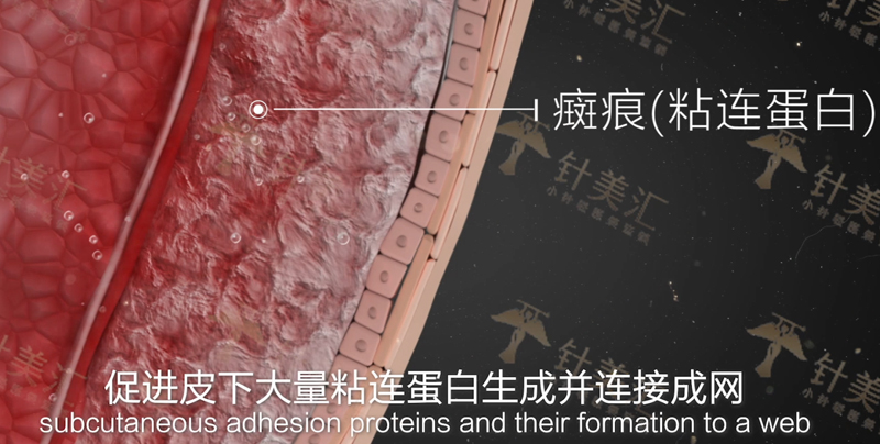 针美汇延缓衰老老