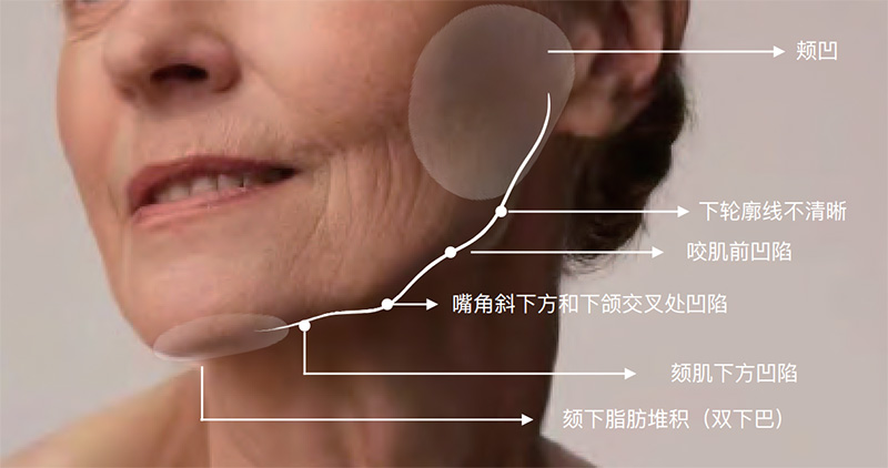 针美汇延缓衰老